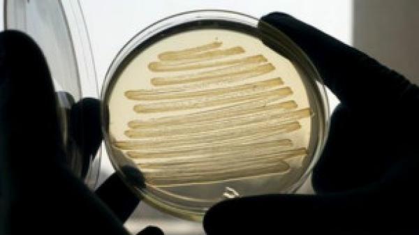 نوع من البكتريا ينتج وقودا حيويا شبيها بالديزل